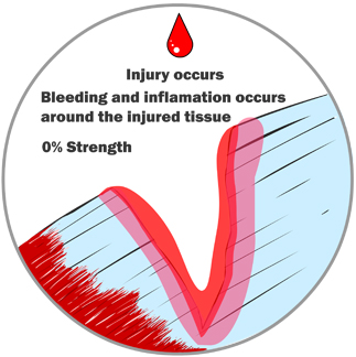 Injury Occurs