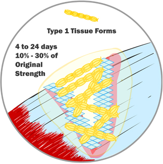 Type 1 Tissue